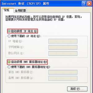 Win7ʼǱIPַΪԶ