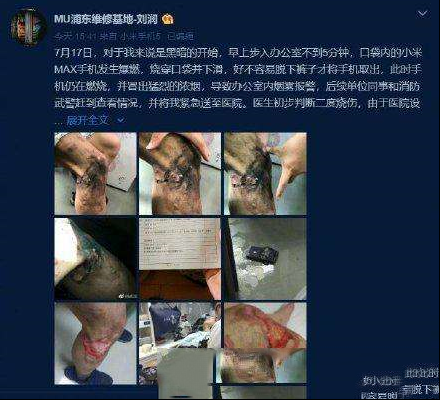 小米Max被爆发生爆燃 致用户右腿遭到二度烧伤